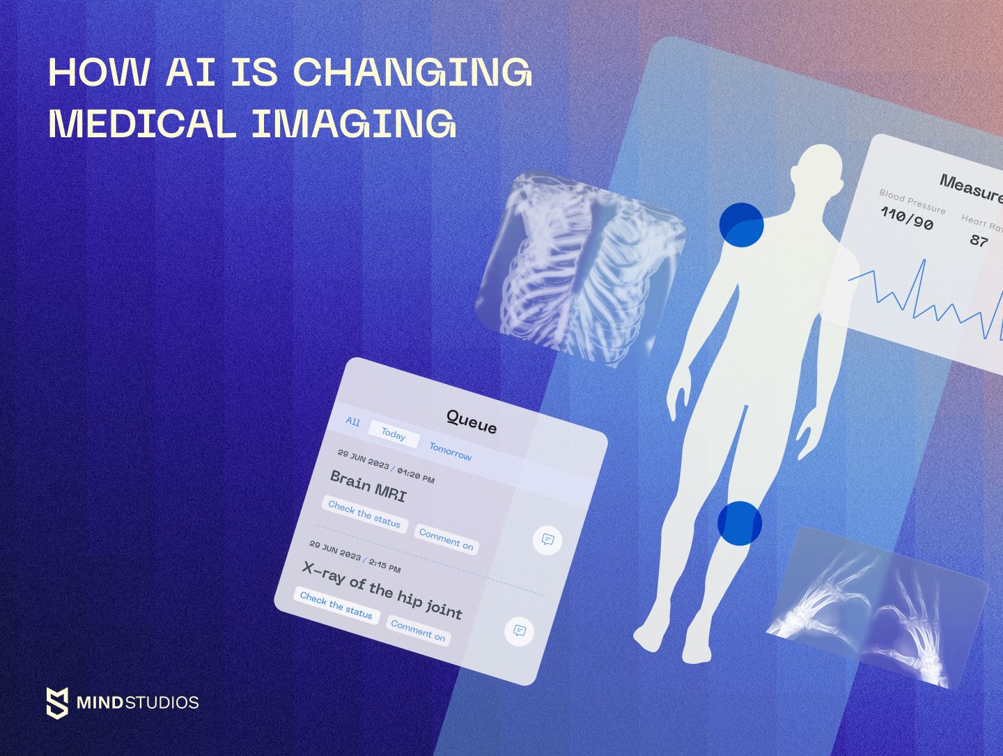 How AI is Changing Medical Imaging Mind Studios